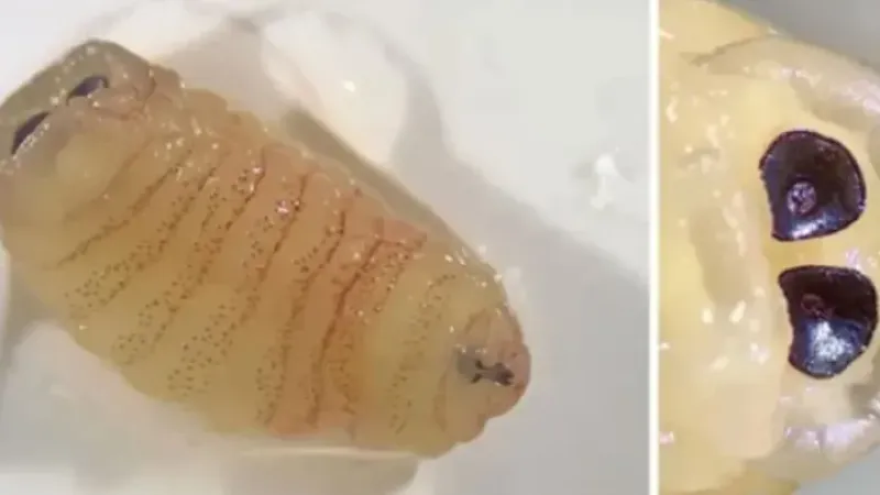 Hapşırınca burnundan çıktı: Yüzüne üşüşen sinekler haftalar sonra..